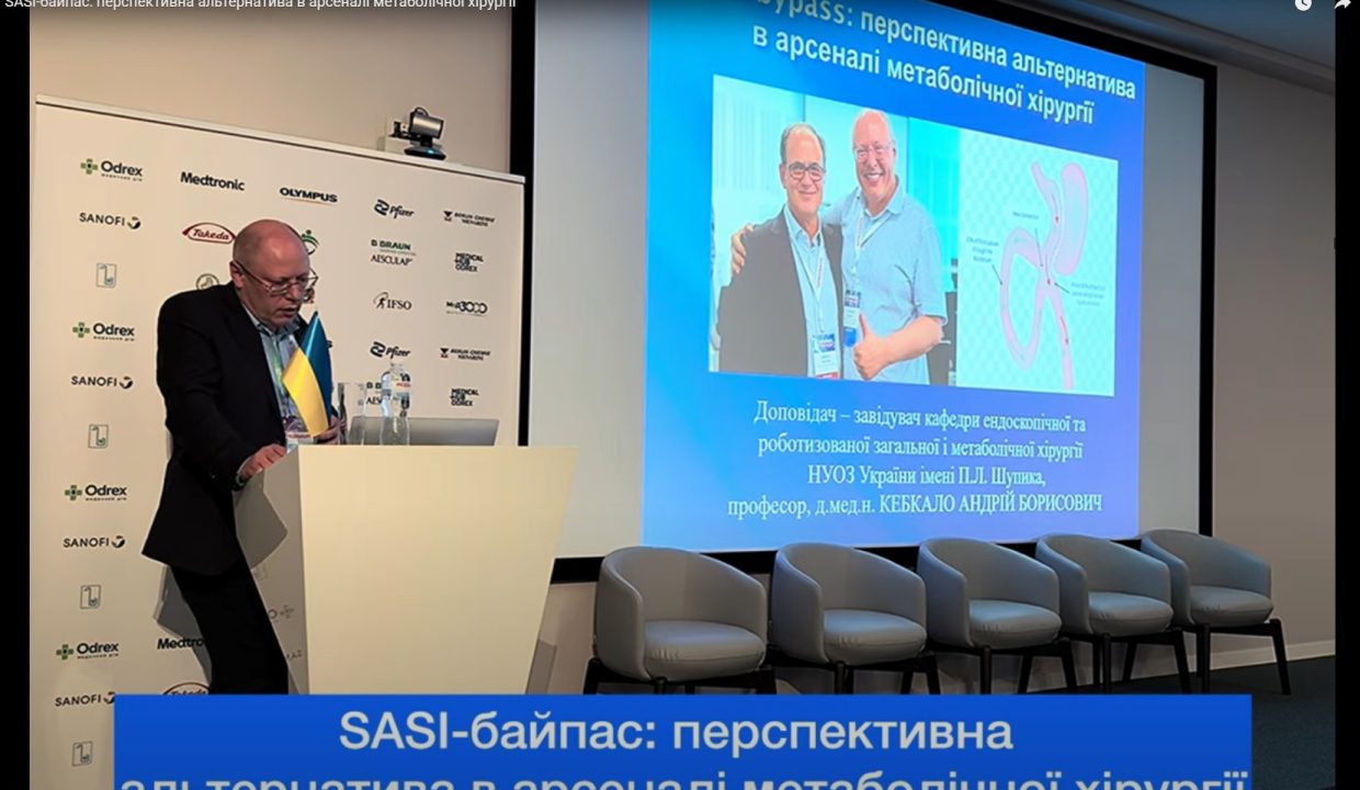 SASI-байпас перспективна альтернатива в арсеналі метаболічної хірургії